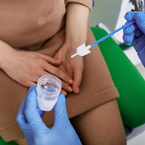 Cancer Screening (Pap Smear & HPV Testing)