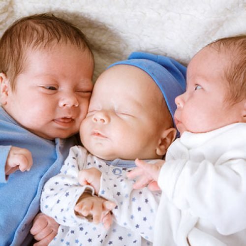 Multiple Pregnancy (Twins-Triplets) Management