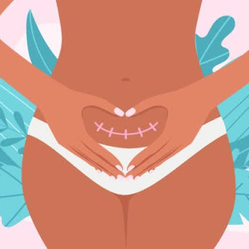 VBAC (Vaginal Birth After Cesarean)