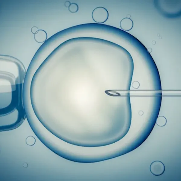 ivf